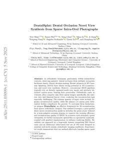 DentalSplat: Dental Occlusion Novel View Synthesis from Sparse Intra-Oral Photographs