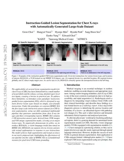 Instruction-Guided Lesion Segmentation for Chest X-rays with Automatically Generated Large-Scale Dataset