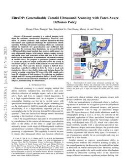 UltraDP: Generalizable Carotid Ultrasound Scanning with Force-Aware Diffusion Policy