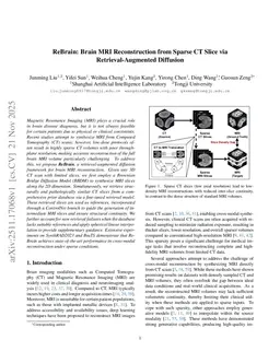 ReBrain: Brain MRI Reconstruction from Sparse CT Slice via Retrieval-Augmented Diffusion