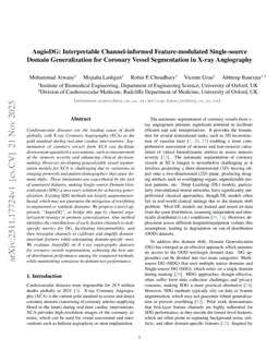 AngioDG: Interpretable Channel-informed Feature-modulated Single-source Domain Generalization for Coronary Vessel Segmentation in X-ray Angiography