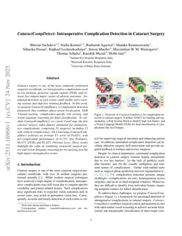 CataractCompDetect: Intraoperative Complication Detection in Cataract Surgery