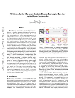 AGENet: Adaptive Edge-aware Geodesic Distance Learning for Few-Shot Medical Image Segmentation