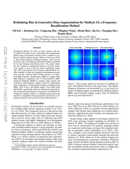 Rethinking Bias in Generative Data Augmentation for Medical AI: a Frequency Recalibration Method