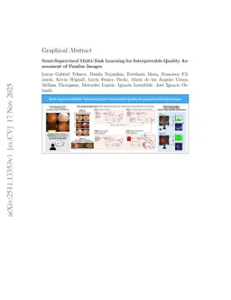 Semi-Supervised Multi-Task Learning for Interpretable Quality As- sessment of Fundus Images
