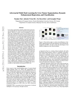 Adversarial Multi-Task Learning for Liver Tumor Segmentation, Dynamic Enhancement Regression, and Classification