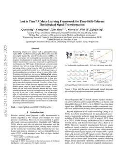 Lost in Time? A Meta-Learning Framework for Time-Shift-Tolerant Physiological Signal Transformation