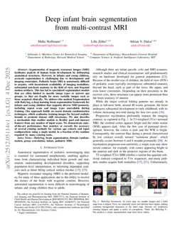 Deep infant brain segmentation from multi-contrast MRI