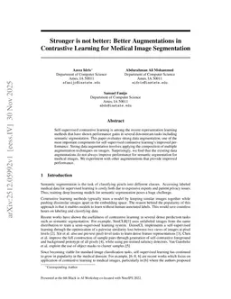 Stronger is not better: Better Augmentations in Contrastive Learning for Medical Image Segmentation