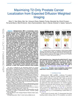 Maximizing T2-Only Prostate Cancer Localization from Expected Diffusion Weighted Imaging