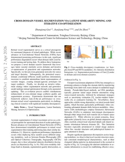 Cross-Domain Vessel Segmentation via Latent Similarity Mining and Iterative Co-Optimization