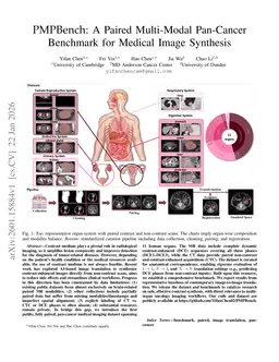 PMPBench: A Paired Multi-Modal Pan-Cancer Benchmark for Medical Image Synthesis