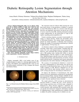 Diabetic Retinopathy Lesion Segmentation through Attention Mechanisms