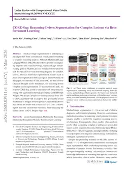 CORE-Seg: Reasoning-Driven Segmentation for Complex Lesions via Reinforcement Learning