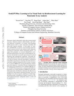 OralGPT-Plus: Learning to Use Visual Tools via Reinforcement Learning for Panoramic X-ray Analysis